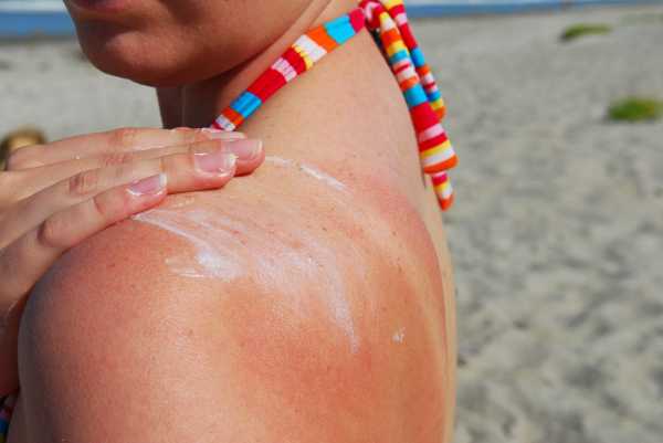 11 questions about sunscreen you should ask before going outside