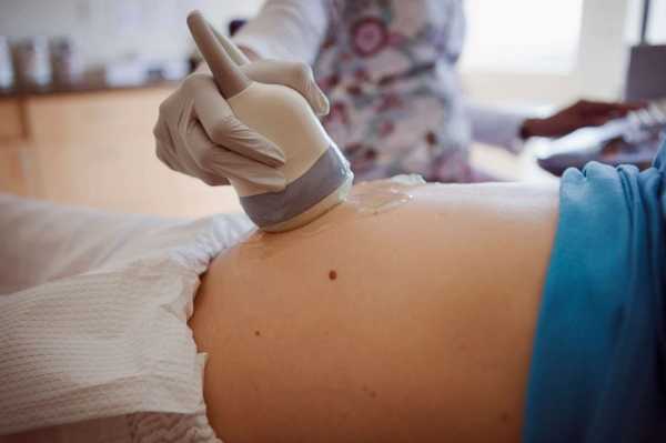 Pregnant women should get the flu vaccine, but only half actually do: CDC