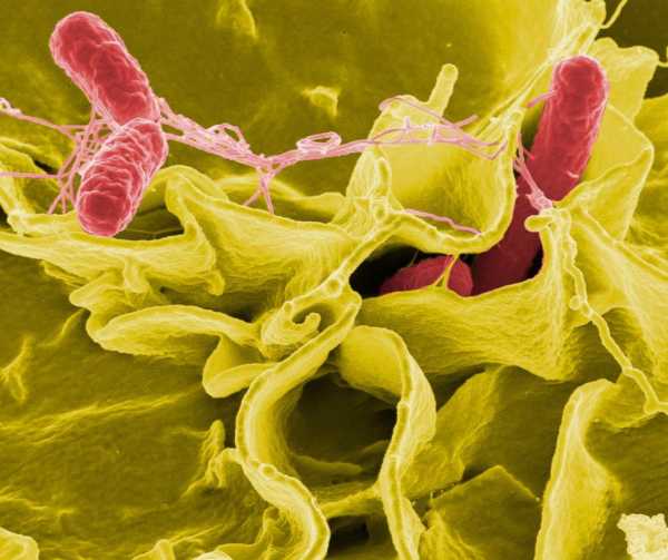 What to know about Salmonella after recent outbreaks have made hundreds ill