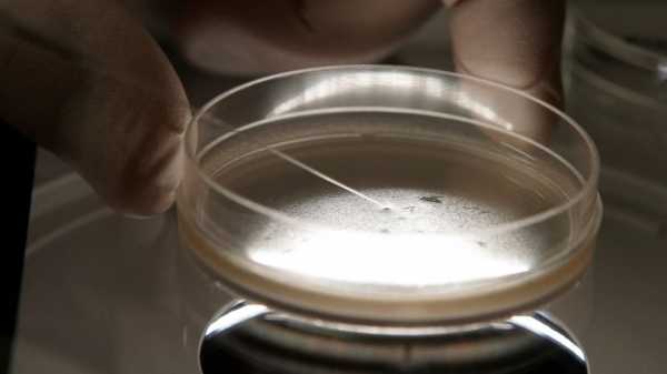 Stem cell shots linked to bacterial infection outbreak